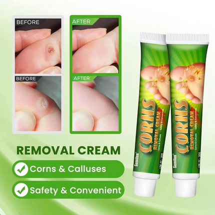 The Key Benefits of Sumifun Corns Removal Cream